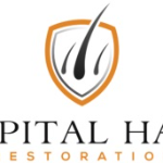 London capitalhairrestoration
